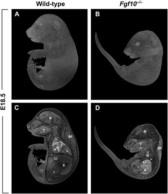 Bones, Glands, Ears and More: The Multiple Roles of FGF10 in Craniofacial Development